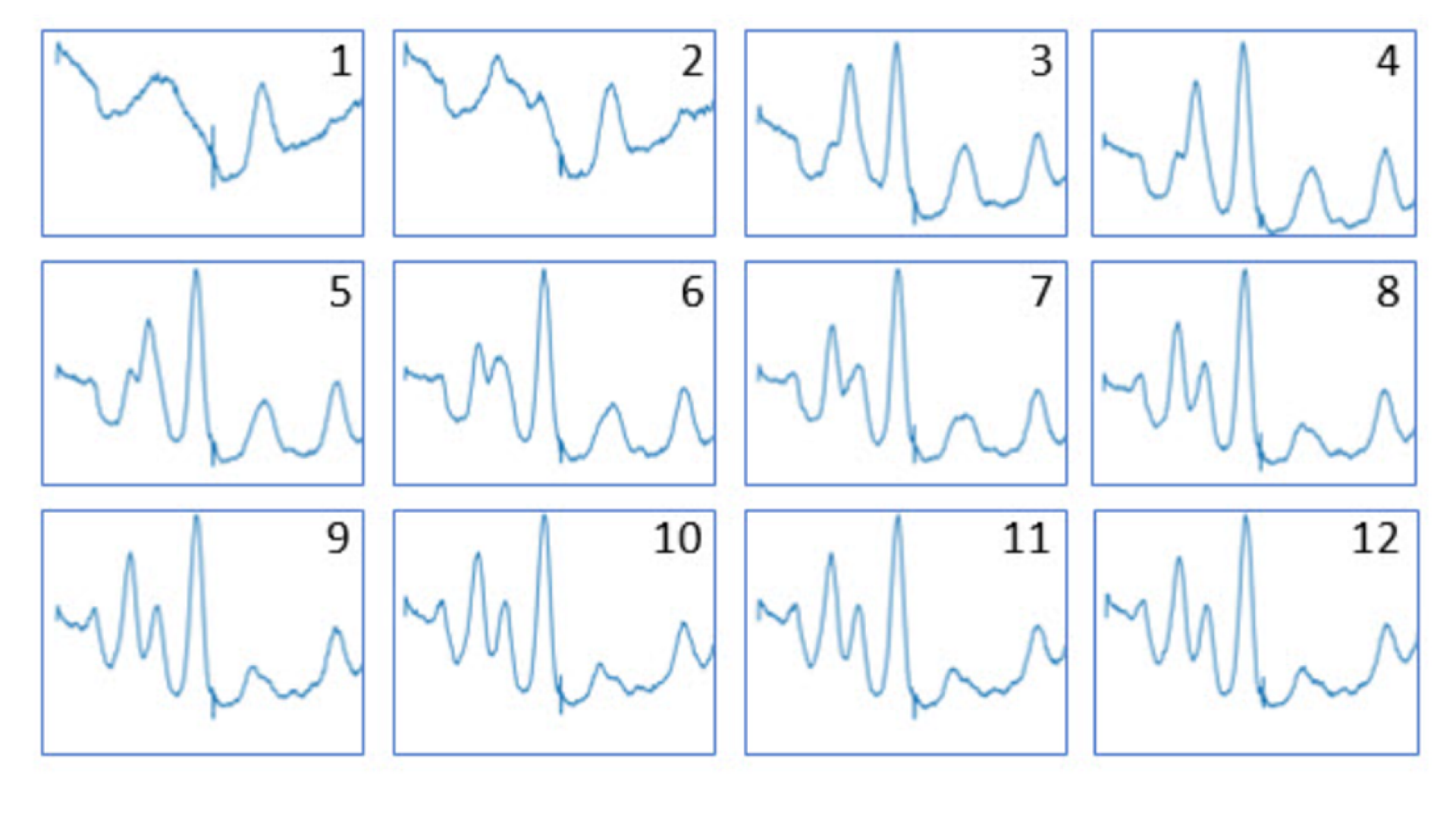  XRD patterns