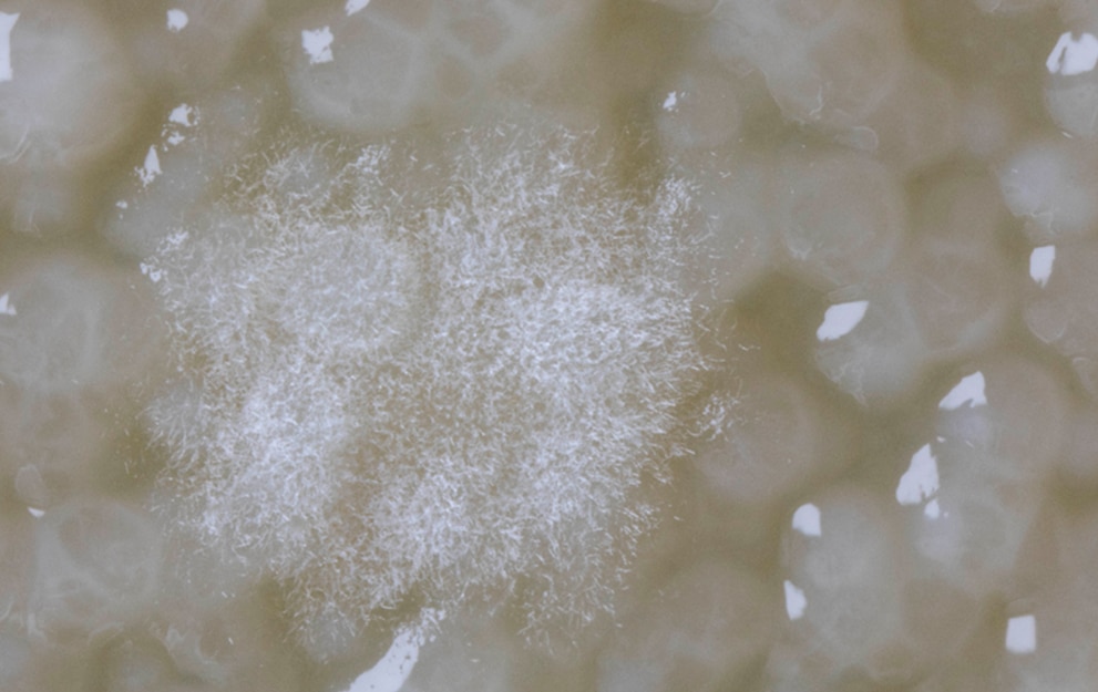 MICROBIOTIFUL CANARD 2