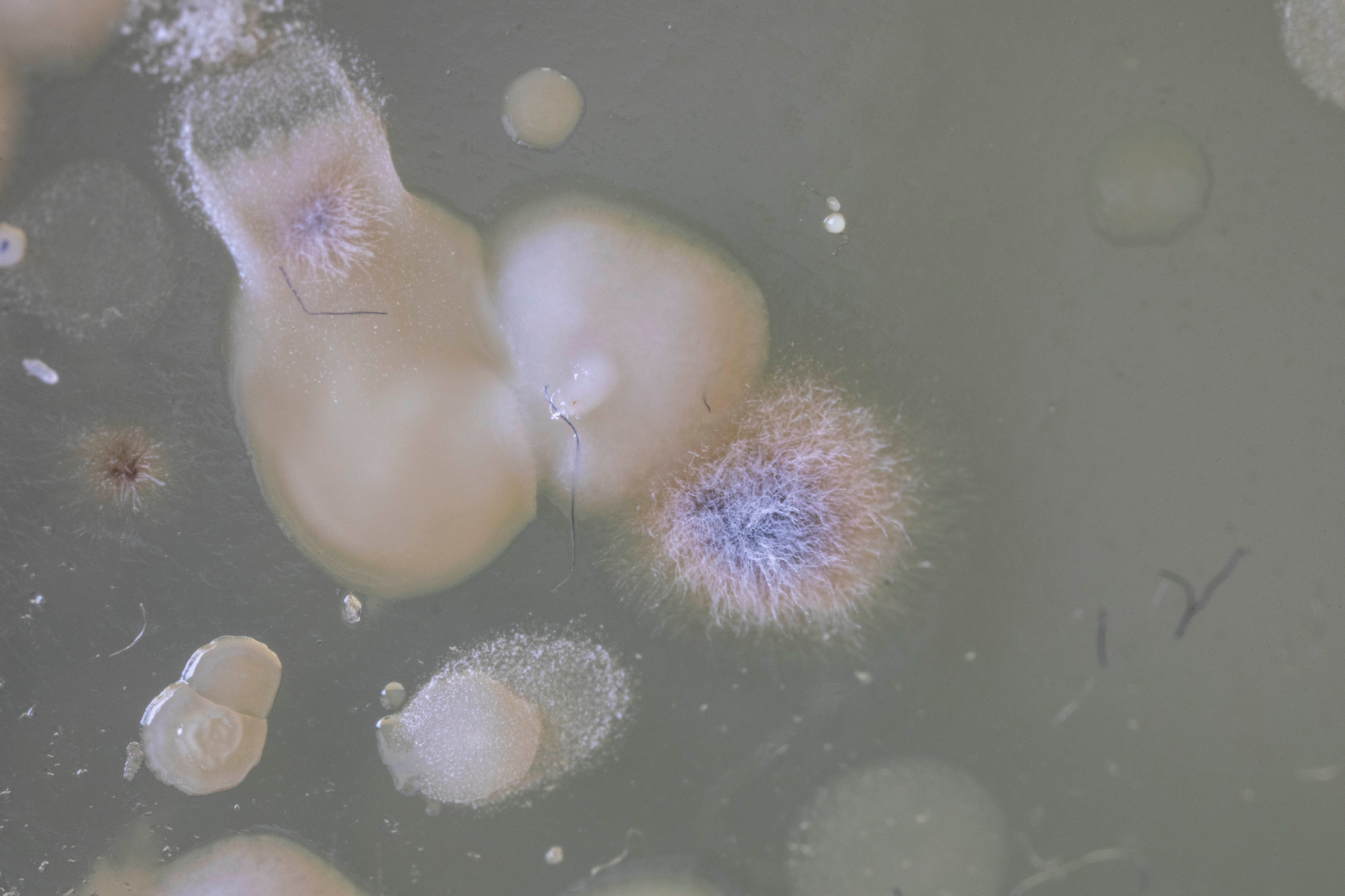 MICROBIOTIFUL SAC A MAIN 1 PETRI MACRO 2