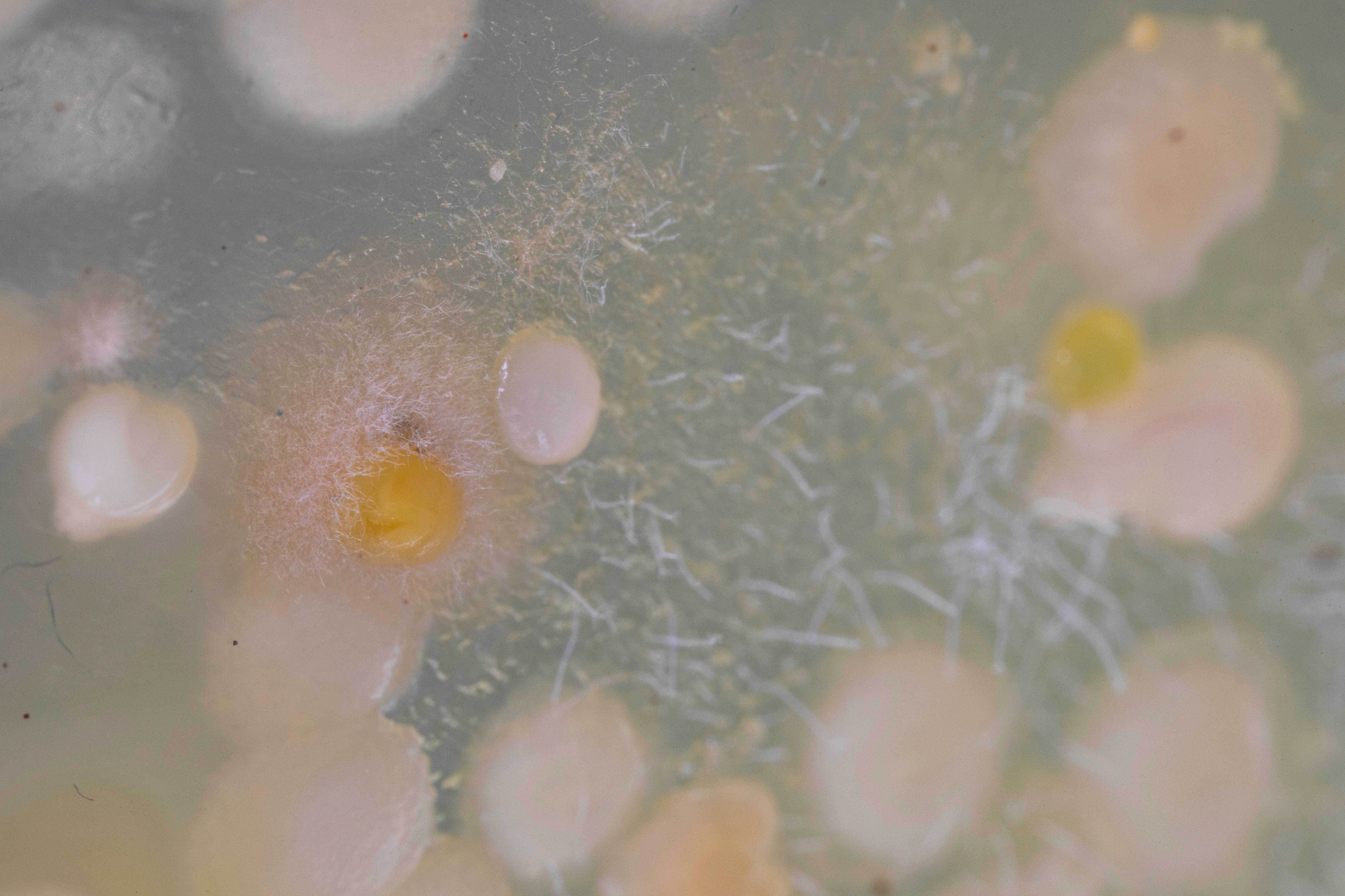 MICROBIOTIFUL SAC A MAIN 1 PETRI MACRO 3