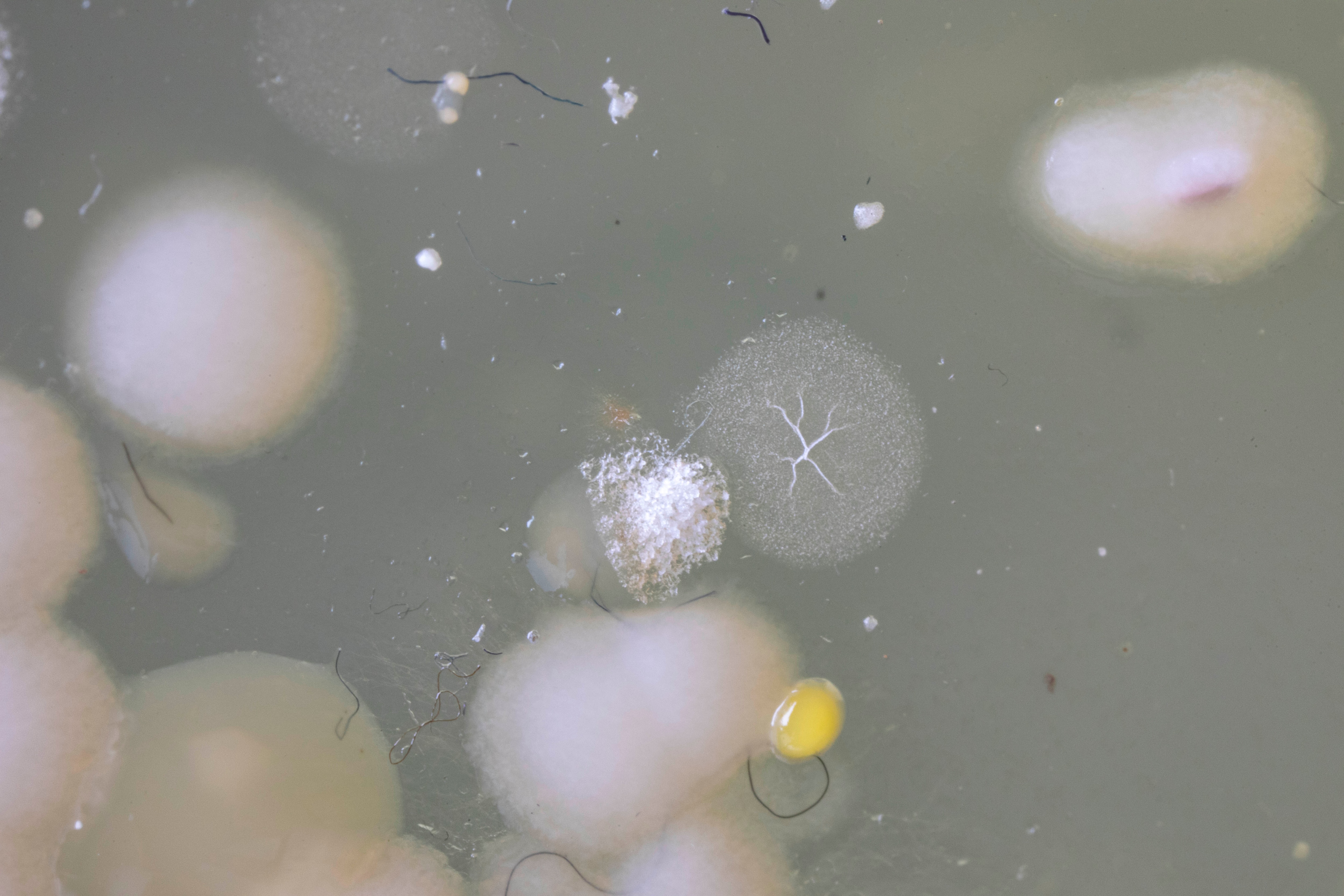 MICROBIOTIFUL SAC A MAIN 1 PETRI MACRO 4