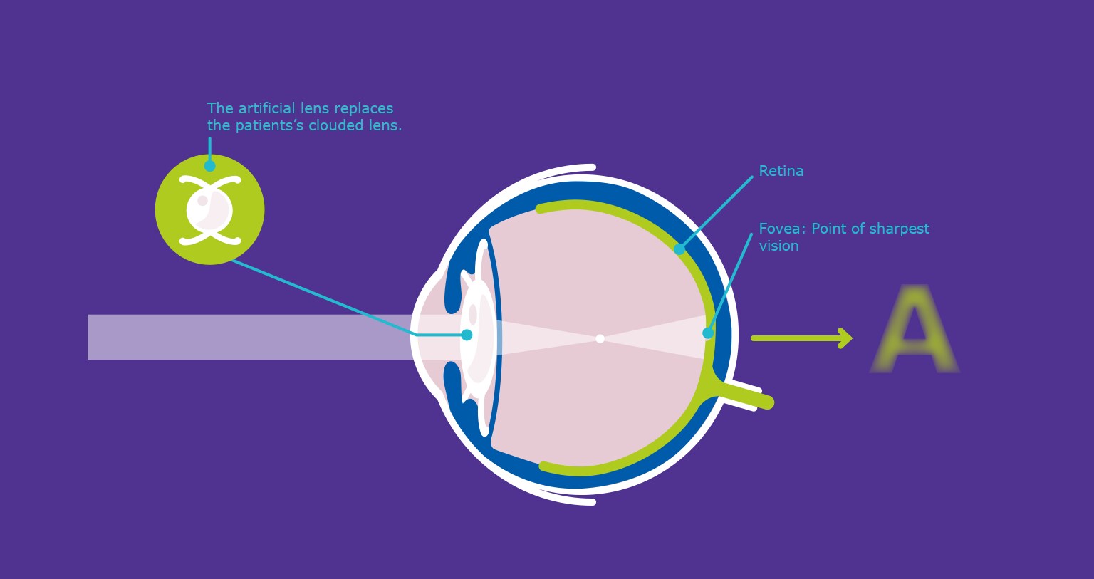 Conventional Method Infographic