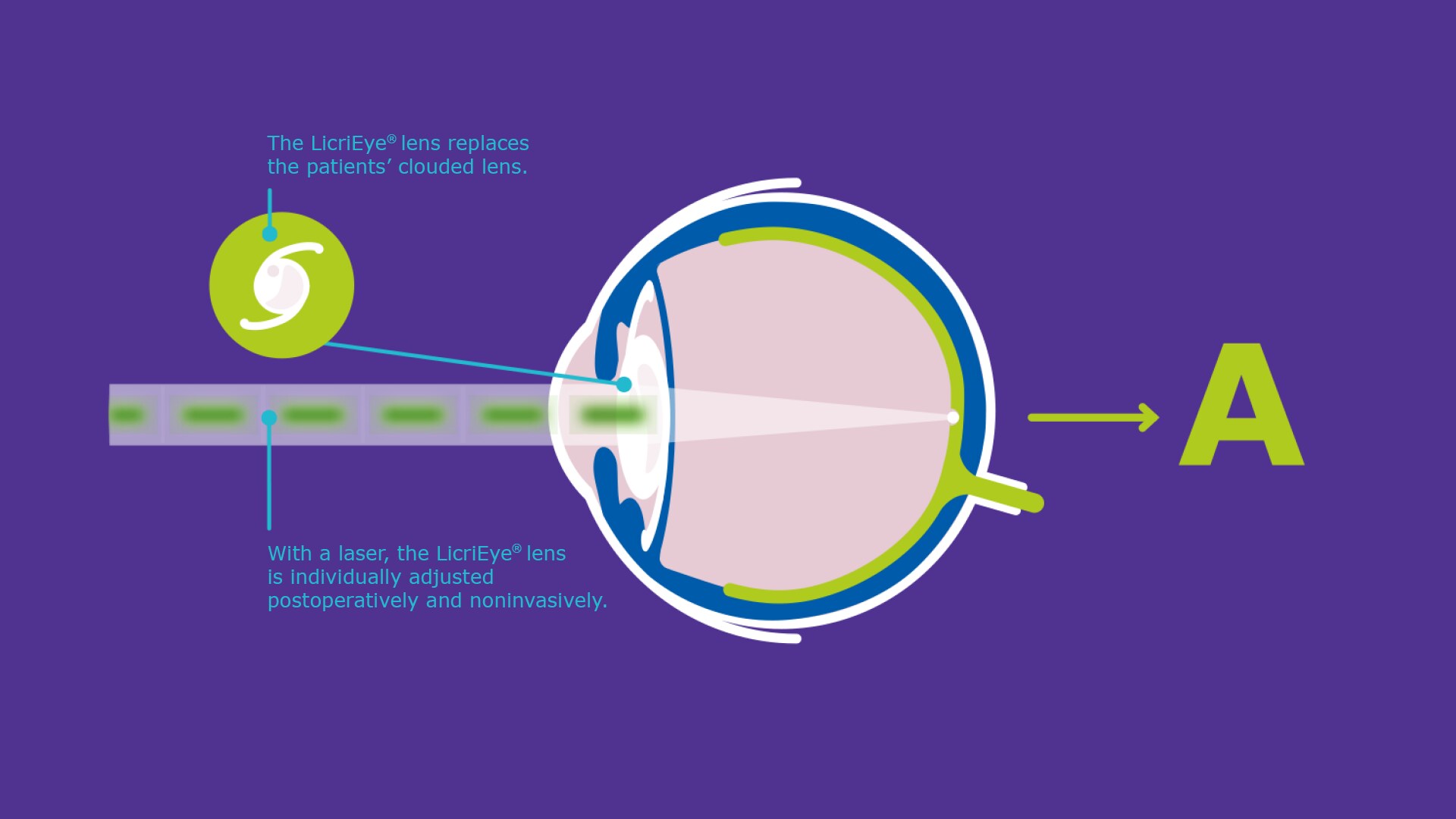 LicriEye Image