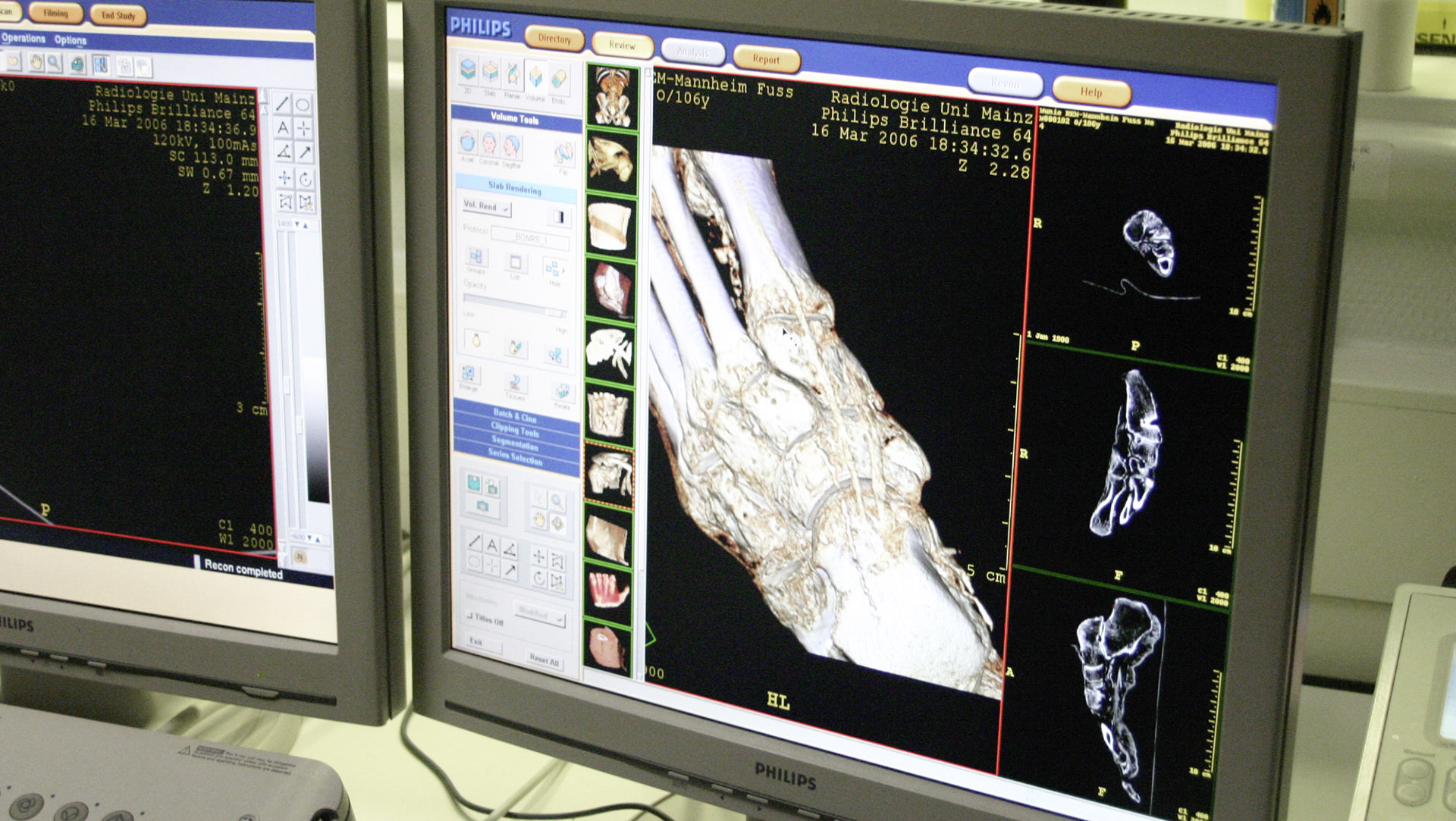 A computer tomograph and the University Clinic in Mainz confirmed that the mummy parts in the Merck KGaA, Darmstadt, Germany collection are genuine. 