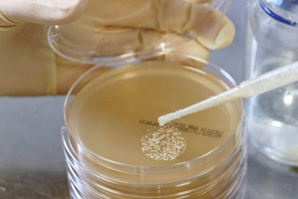 A pipette is used to set the eggs on the culture medium in a Petri dish