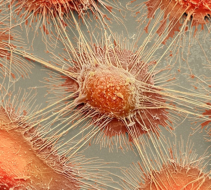 Garry Abelev and colleagues identify the first cancer-specific antigen.