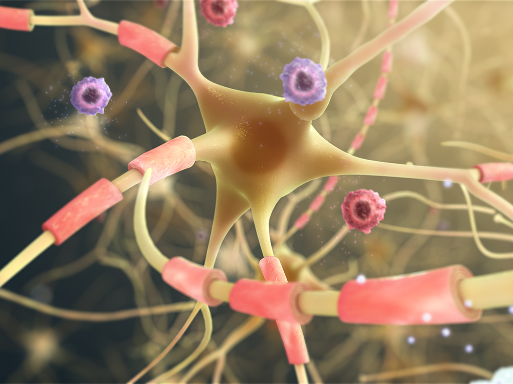 Understanding the Science behind MS